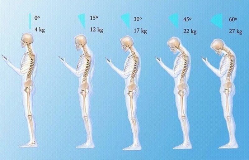 Mobile phones can adversely affect neck posture